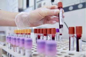 Nuovi_test_genomici_per_il_car