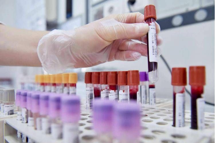 Nuovi_test_genomici_per_il_car
